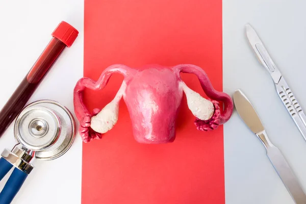 Diagnóstico Quirúrgico Tratamiento Quirúrgico Enfermedades Del Útero Ovarios Cuello Uterino —  Fotos de Stock