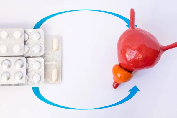 Стек Пухирів Таблетками Або Таблетками Позначений Стрілками Анатомічній Моделі Простати — стокове фото