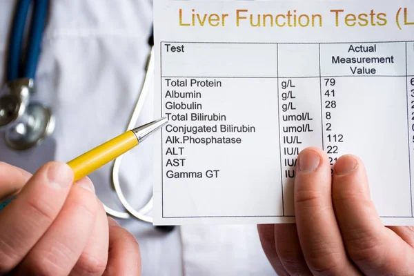 Doctor showing to patient or colleague on liver function test result LFT, standing in white medical coat. Concept photo to illustrate diagnostic and screening of liver diseases or disorders
