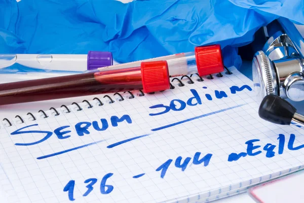 Sodium in serum or blood in basic metabolic test. Laboratory test tubes with blood, stethoscope, smear or film and gloves are near note with text serum sodium on table in doctor office