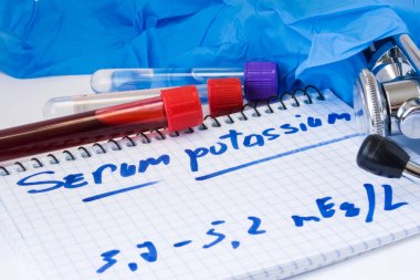 Serumu veya temel metabolik test kanda potasyum. Laboratuvar test tüpleri ile kan yayma, stetoskop veya film ve eldiven metin serum potasyum doktor ofiste tabloda notla yakındır