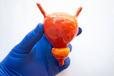 İdrar kesesi ve prostat bezinin gerçekçi anatomik modeli doktor, sağlık uzmanı ya da mavi eldiven giyen bilim adamının elinde. İdrar tahlili anatomisi konsepti 
