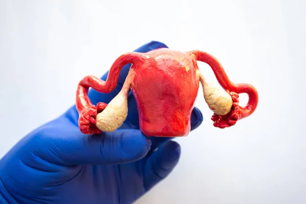 卵巣を持つ子宮の現実的な解剖学的モデルは 医療専門家や青手袋を着用科学者の手にあります 解剖学研究の概念写真 女性生殖の病気 — ストック写真