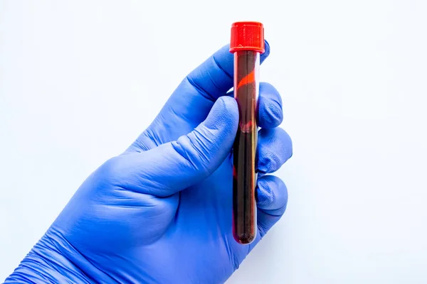 Scientist Laboratory Worker Doctor Holds Tube Blood White Background His — Stock Photo, Image