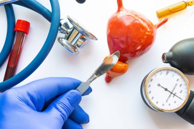 Ürolojik cerrahinin konsept fotoğrafı, prostat veya mesane ameliyatı. Elinde neşter olan doktor, tıbbi alet çantasının yanında bulunan insan prostatı figüründe kesik atıyor. Stetoskop.