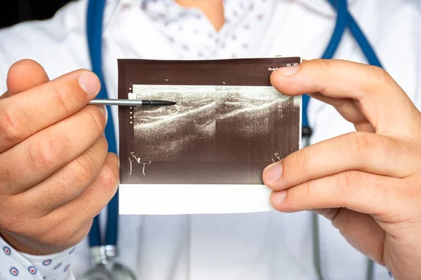 Mastikační Hypertrofie Pravé Straně Snímku Ultrazvukového Snímku Lékař Indikující Pomocí — Stock fotografie