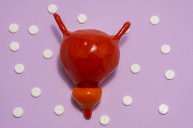 Anatomik orijinale karşılık gelen idrar kesesi ve prostatın modeli veya şekli mor arka planda polka noktalarıyla süslenmiş beyaz haplarla çevrili. Ürolojide kullanmak için fotoğraf