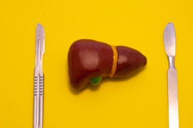 Karaciğer ve safra kesesi cerrahi tedavisinin konsept fotoğrafı. Karaciğerin anatomik figürü sarı arka planda, iki krom metal neşterin yanında yatar. Hepatobilier cerrahide kullanım için