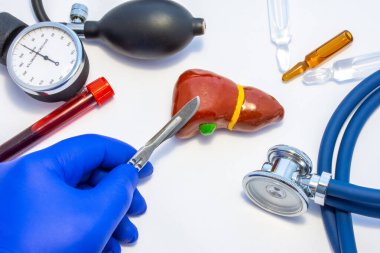 Karaciğer ameliyatı, karaciğer rezeksiyonu ya da hepatektomi. Elinde neşter olan doktor tıbbi alet çantasının yanında bulunan insan karaciğerine kesik atıyor. Stetoskop.
