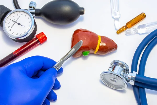 Concept Photo Liver Surgery Operation Liver Resection Hepatectomy Doctor Scalpel — Stock Photo, Image