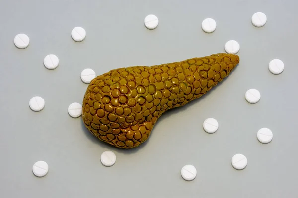 Anatomical realistic figure or model of human or animal pancreas gland on gray background, surrounded by white tablets or pills, which are arranged in polka-dot ornament. Photos for use in medicine