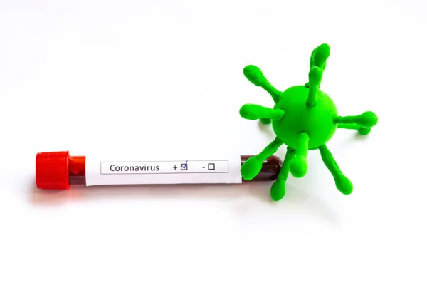 Modèle Coronavirus Covid Les Éprouvettes Avec Coronavirus Marqué Sang Résultat — Photo