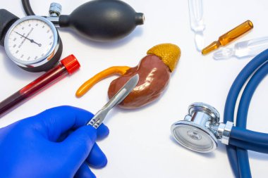Böbrek ameliyatı, böbrek rezeksiyonu ya da nefrektomi resmi. Elinde neşter olan doktor, tıbbi alet çantasının yanında bulunan insan böbreği figüründe kesi yapar. Stetoskop.