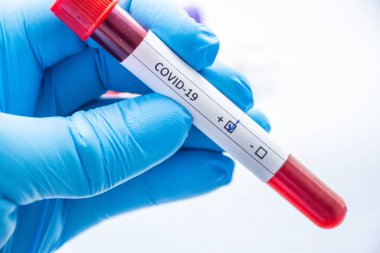 Laboratuvar teknisyeni, tıp uzmanı, doktor ya da bilim adamı elinde CoVID-19 'un yazıldığı kan testi tüpü tutuyor ve Coronavirus analizinin pozitif sonucu kameraya yakın çekim gösteriliyor.