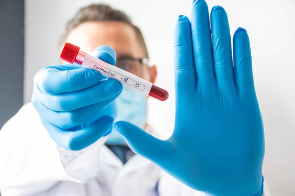 Médico Profissional Médico Especialista Doenças Infecciosas Detém Tubo Teste Laboratório — Fotografia de Stock