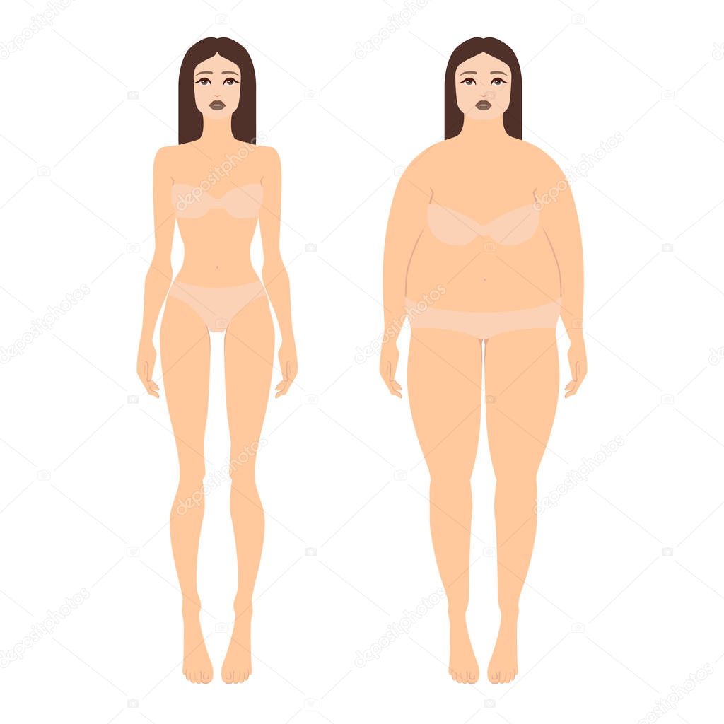 Vector illustration of two women with different figures in underwear. Female full body shape in flat style, front view. Set of bodies before and after weight loss