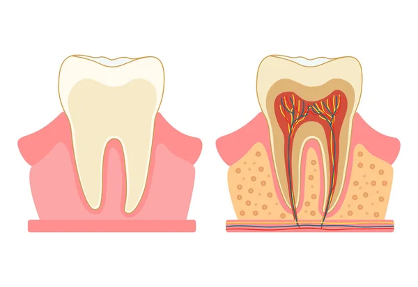 Dente Cortado Diagrama Médico Estrutura Secção Transversal Interna Dente Conceito — Vetor de Stock