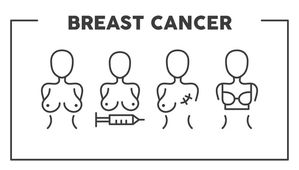 Operacja raka piersi. Operacja usunięcia piersi. Elementy symbolu ilustracji wektorowej do projektowania stron internetowych — Wektor stockowy