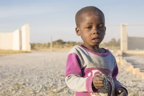 Portret Lubango/Angola - 13 lipca 2016 - chore dziecko z Afryki — Zdjęcie stockowe