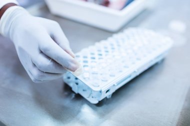 Forseps ve laboratuvar tüpleriyle bilim adamı eli.