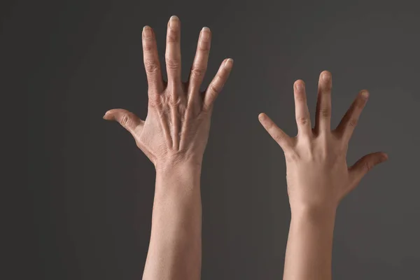 Человеческие руки вверх — стоковое фото