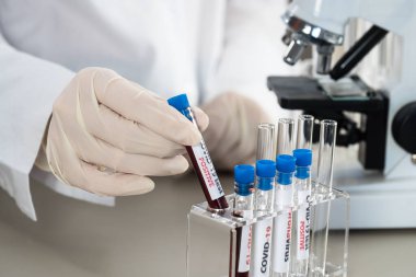 NCoV-2019 için kanla test tüpü tutan hemşire laboratuvarda Coronavirus testi konseptini analiz ediyor.