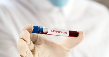 NCoV-2019 için kanla test tüpü tutan hemşire laboratuvarda Coronavirus testi konseptini analiz ediyor.