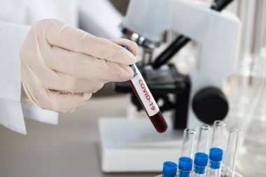 NCoV-2019 için kanla test tüpü tutan hemşire laboratuvarda Coronavirus testi konseptini analiz ediyor.