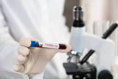 NCoV-2019 için kanla test tüpü tutan hemşire laboratuvarda Coronavirus testi konseptini analiz ediyor.