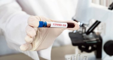 NCoV-2019 için kanla test tüpü tutan hemşire laboratuvarda Coronavirus testi konseptini analiz ediyor.