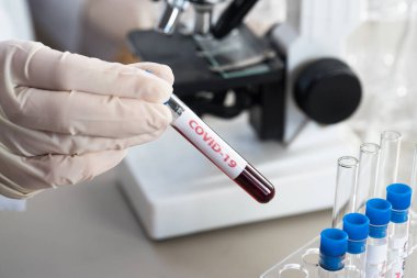 NCoV-2019 için kanla test tüpü tutan hemşire laboratuvarda Coronavirus testi konseptini analiz ediyor.