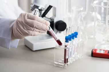 NCoV-2019 için kanla test tüpü tutan hemşire laboratuvarda Coronavirus testi konseptini analiz ediyor.
