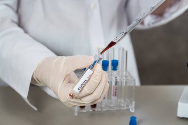 NCoV-2019 için kanla test tüpü tutan hemşire laboratuvarda Coronavirus testi konseptini analiz ediyor.