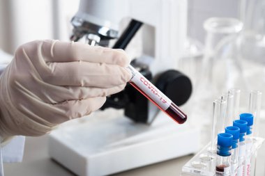 NCoV-2019 için kanla test tüpü tutan hemşire laboratuvarda Coronavirus testi konseptini analiz ediyor.