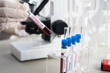 NCoV-2019 için kanla test tüpü tutan hemşire laboratuvarda Coronavirus testi konseptini analiz ediyor.