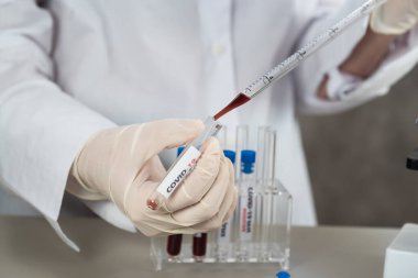 NCoV-2019 için kanla test tüpü tutan hemşire laboratuvarda Coronavirus testi konseptini analiz ediyor.
