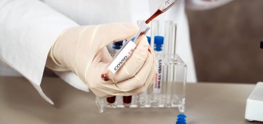 NCoV-2019 için kanla test tüpü tutan hemşire laboratuvarda Coronavirus testi konseptini analiz ediyor.