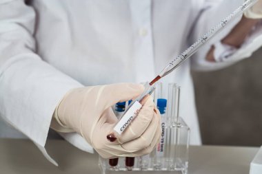 NCoV-2019 için kanla test tüpü tutan hemşire laboratuvarda Coronavirus testi konseptini analiz ediyor.