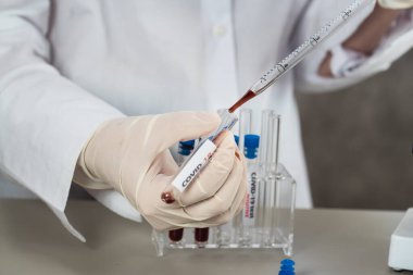 NCoV-2019 için kanla test tüpü tutan hemşire laboratuvarda Coronavirus testi konseptini analiz ediyor.