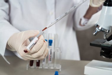 NCoV-2019 için kanla test tüpü tutan hemşire laboratuvarda Coronavirus testi konseptini analiz ediyor.