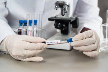 NCoV-2019 için kanla test tüpü tutan hemşire laboratuvarda Coronavirus testi konseptini analiz ediyor.