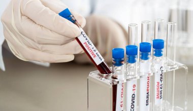 NCoV-2019 için kanla test tüpü tutan hemşire laboratuvarda Coronavirus testi konseptini analiz ediyor.