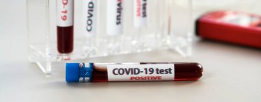 NCoV-2019 için kanla test tüpü tutan hemşire laboratuvarda Coronavirus testi konseptini analiz ediyor.