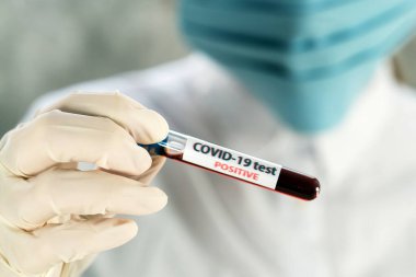 NCoV-2019 için kanla test tüpü tutan hemşire laboratuvarda Coronavirus testi konseptini analiz ediyor.