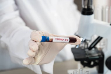 NCoV-2019 için kanla test tüpü tutan hemşire laboratuvarda Coronavirus testi konseptini analiz ediyor.