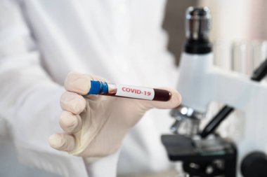 NCoV-2019 için kanla test tüpü tutan hemşire laboratuvarda Coronavirus testi konseptini analiz ediyor.