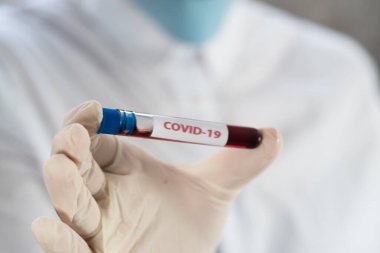 NCoV-2019 için kanla test tüpü tutan hemşire laboratuvarda Coronavirus testi konseptini analiz ediyor.