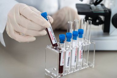 NCoV-2019 için kanla test tüpü tutan hemşire laboratuvarda Coronavirus testi konseptini analiz ediyor.