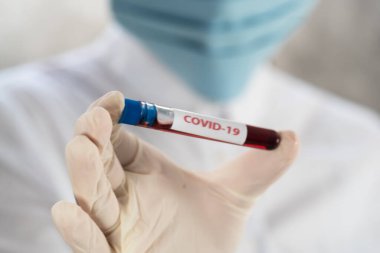 NCoV-2019 için kanla test tüpü tutan hemşire laboratuvarda Coronavirus testi konseptini analiz ediyor.