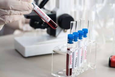 NCoV-2019 için kanla test tüpü tutan hemşire laboratuvarda Coronavirus testi konseptini analiz ediyor.